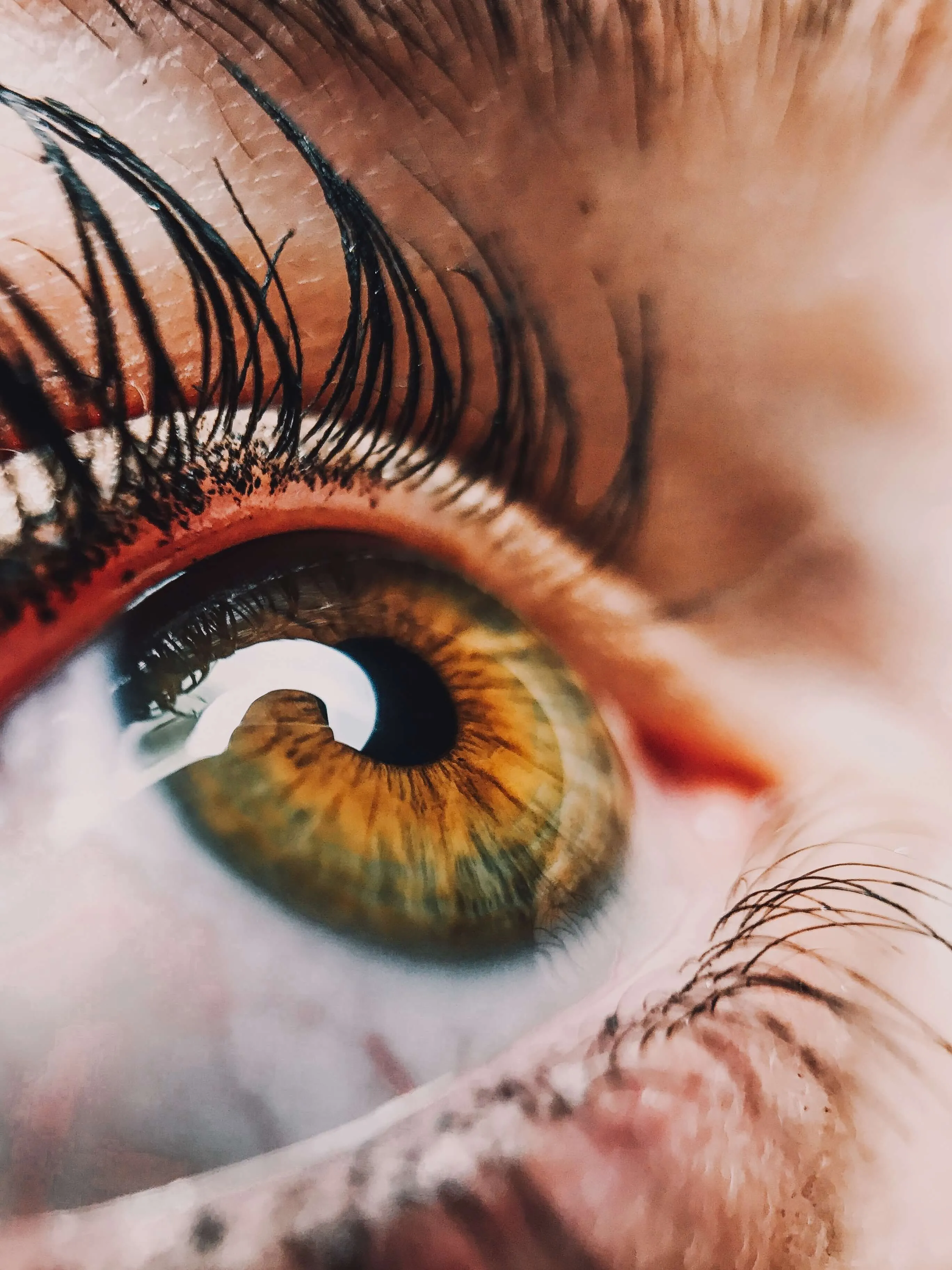 eye-img